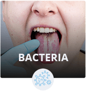 BACTERIA